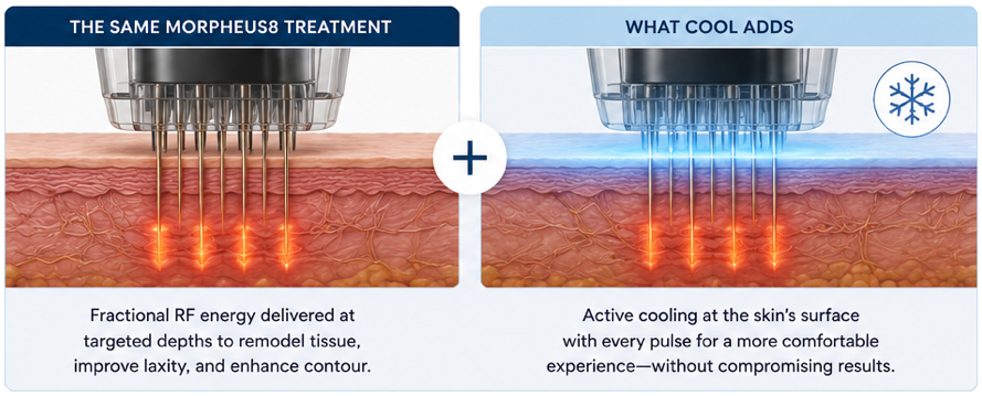 Morpheus8 Cool Microneedling